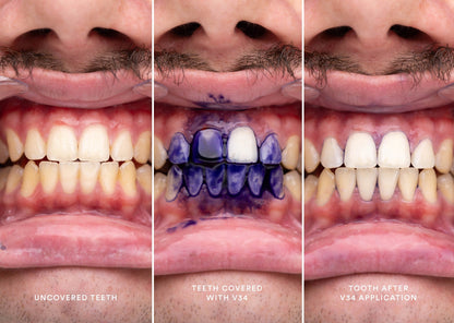 SmileKit™