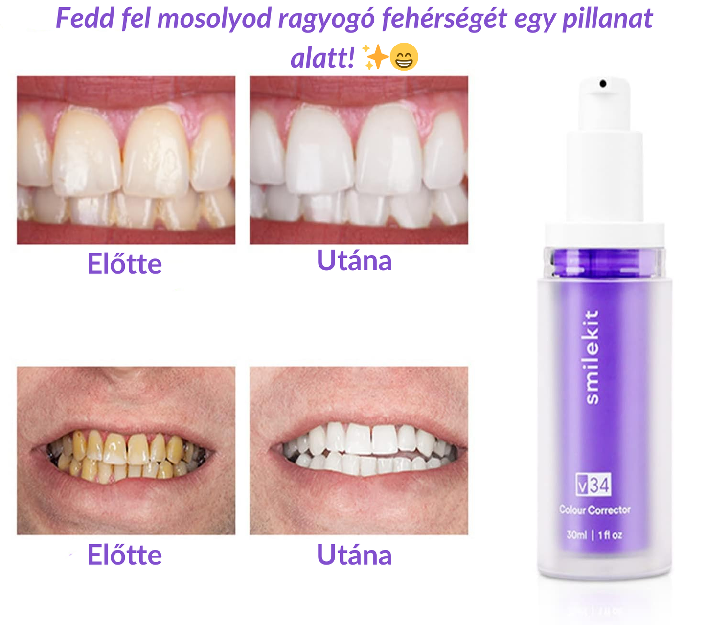 SmileKit™